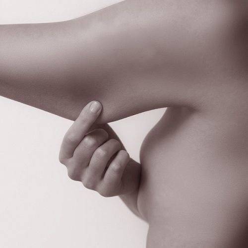 lifting braquial - cirugia murcia