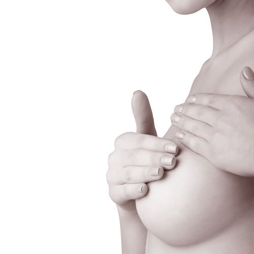 mamas tuberosas - cirugía